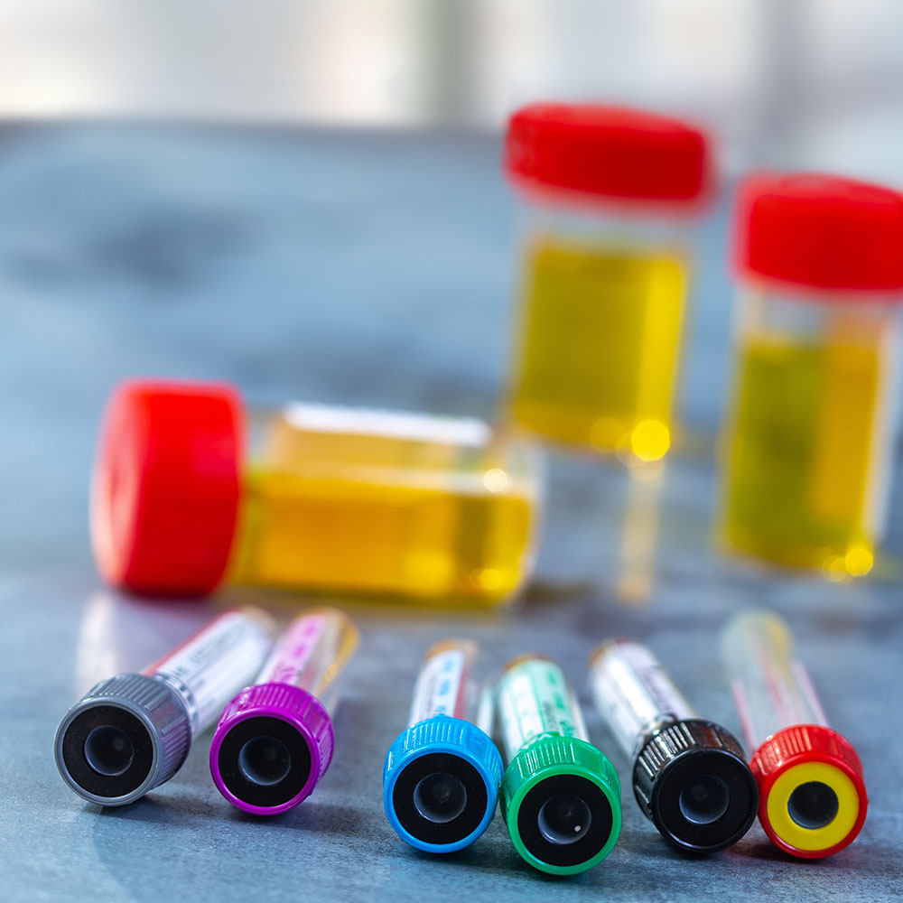 Coloured tubes and urine samples